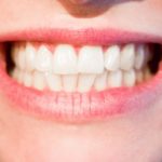 Obecna technika wykorzystywana w salonach stomatologii estetycznej może spowodować, że odbierzemy prześliczny uśmiech.